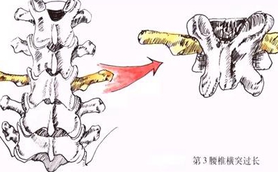 杭州康復養老之家是杭州康復醫院，杭州養老院，杭州公立康復中心，杭州醫養結合護理院信息一站式分享平臺。