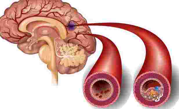 杭州康復養老之家是杭州康復醫院，杭州養老院，杭州公立康復中心，杭州醫養結合護理院信息一站式分享平臺。