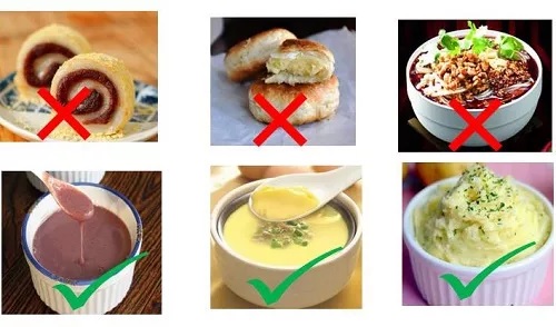 吞咽障礙康復 吞咽障礙康復