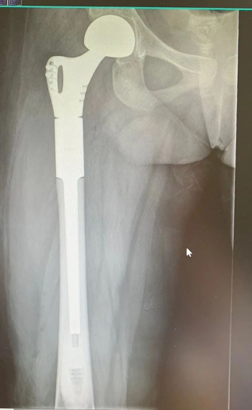 杭州康復養老之家是杭州康復醫院，杭州養老院，杭州公立康復中心，杭州醫養結合護理院信息一站式分享平臺。