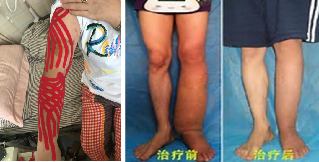 杭州康復養老之家是杭州康復醫院，杭州養老院，杭州公立康復中心，杭州醫養結合護理院信息一站式分享平臺。