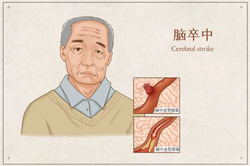 杭州康復養老之家是杭州康復醫院，杭州養老院，杭州公立康復中心，杭州醫養結合護理院信息一站式分享平臺。