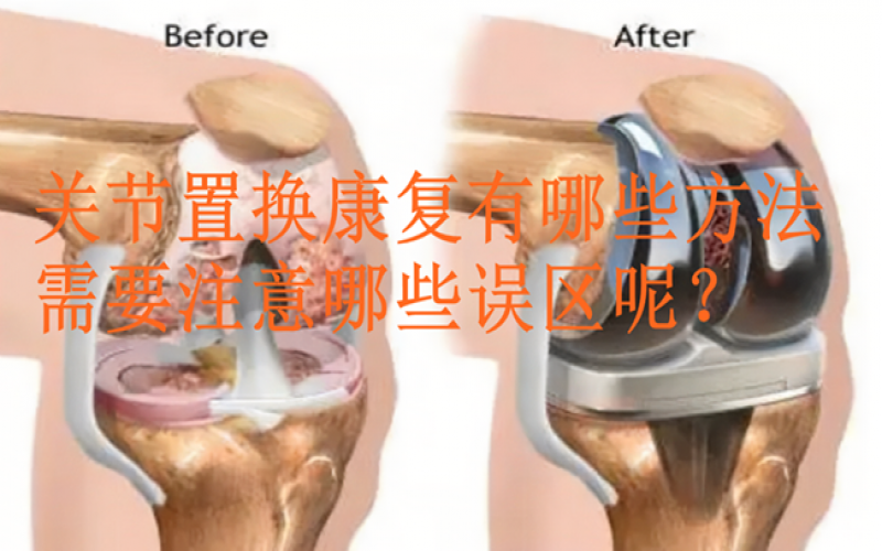 關節置換康復有哪些方法，需要注意哪些誤區呢？